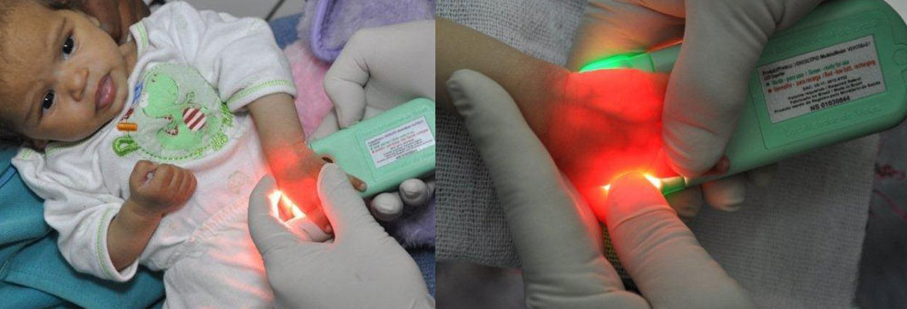 Venoscópio Venos Baby Localizador de Veias