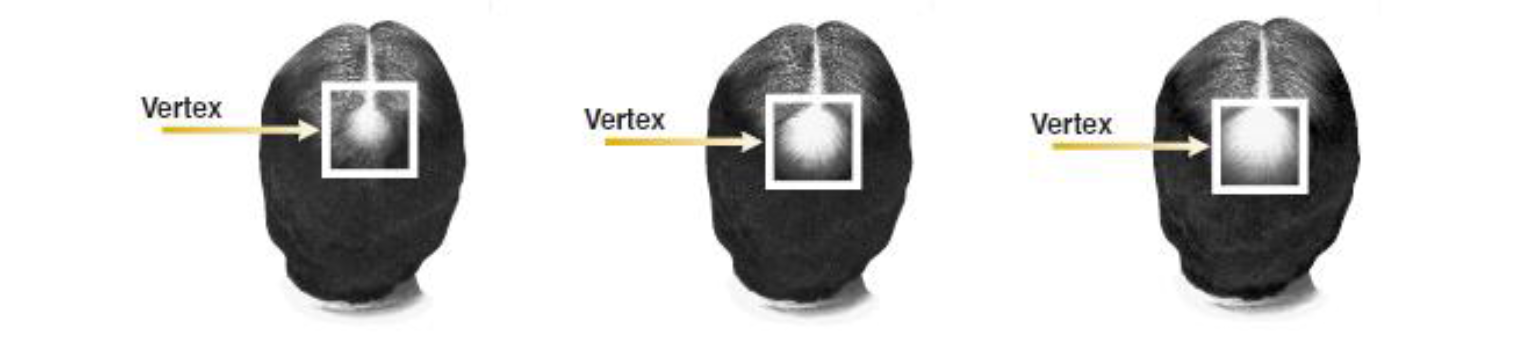 vertex-minoxidil-members-mark-primo-suplementos