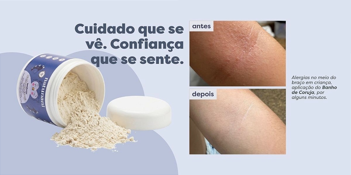 Banner extra 2 vitrine-destaque