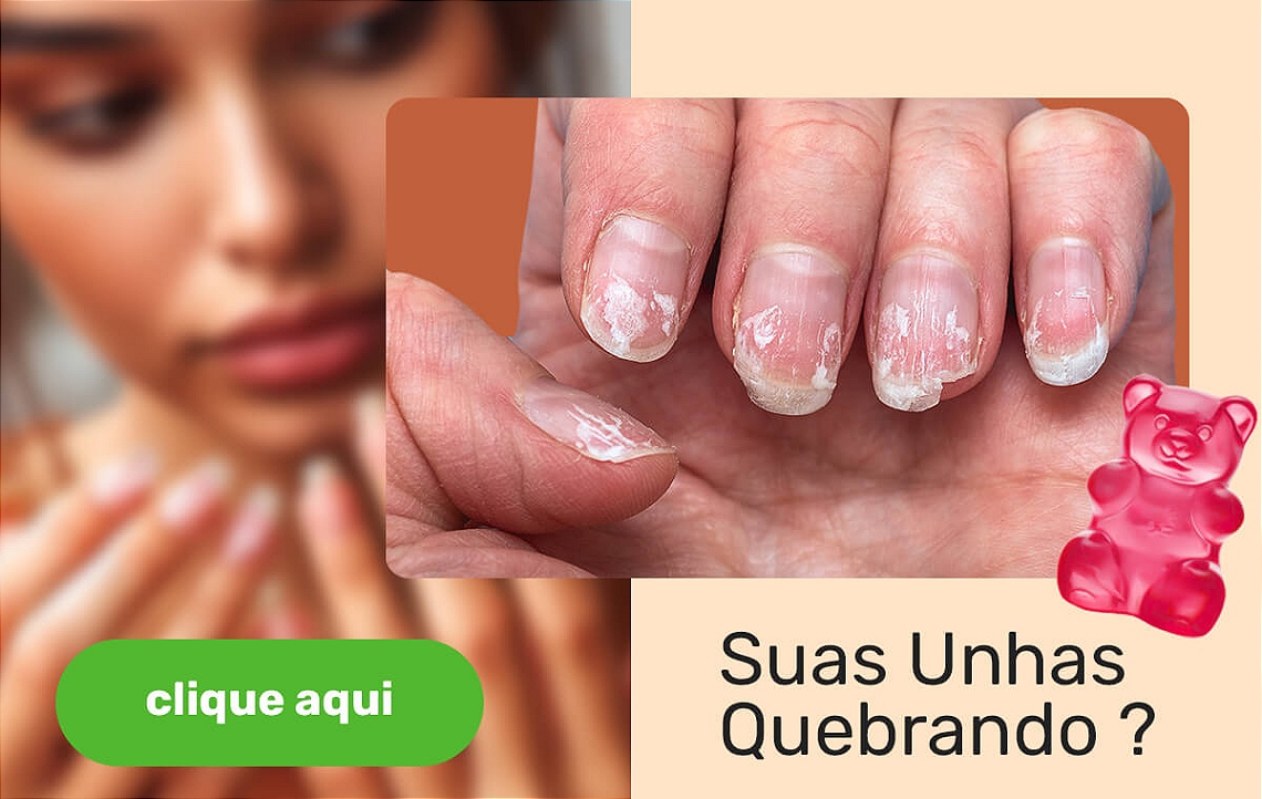 UNHAS vitrine-mini