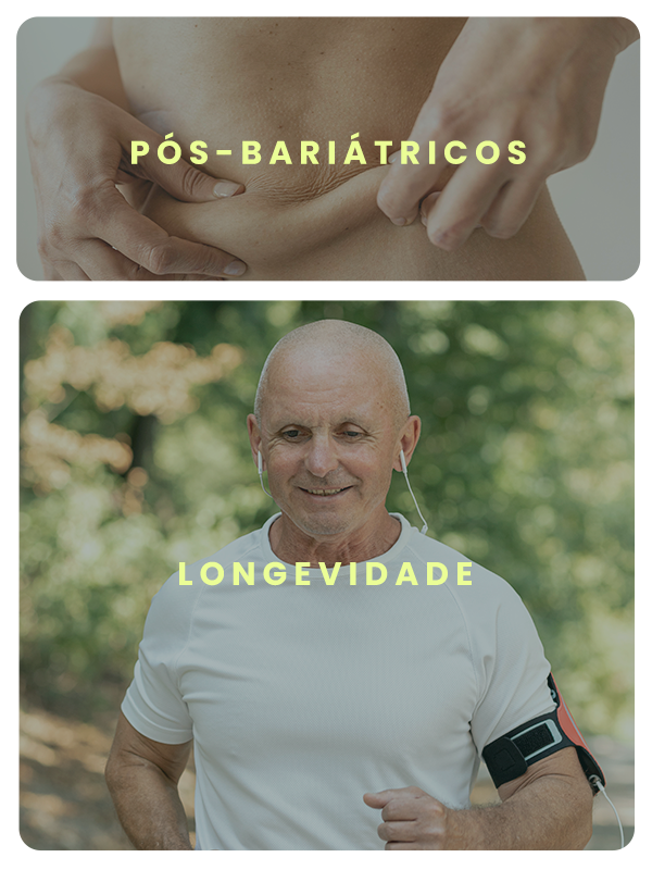 pos bariatricos lengevidade vitrine-23156120