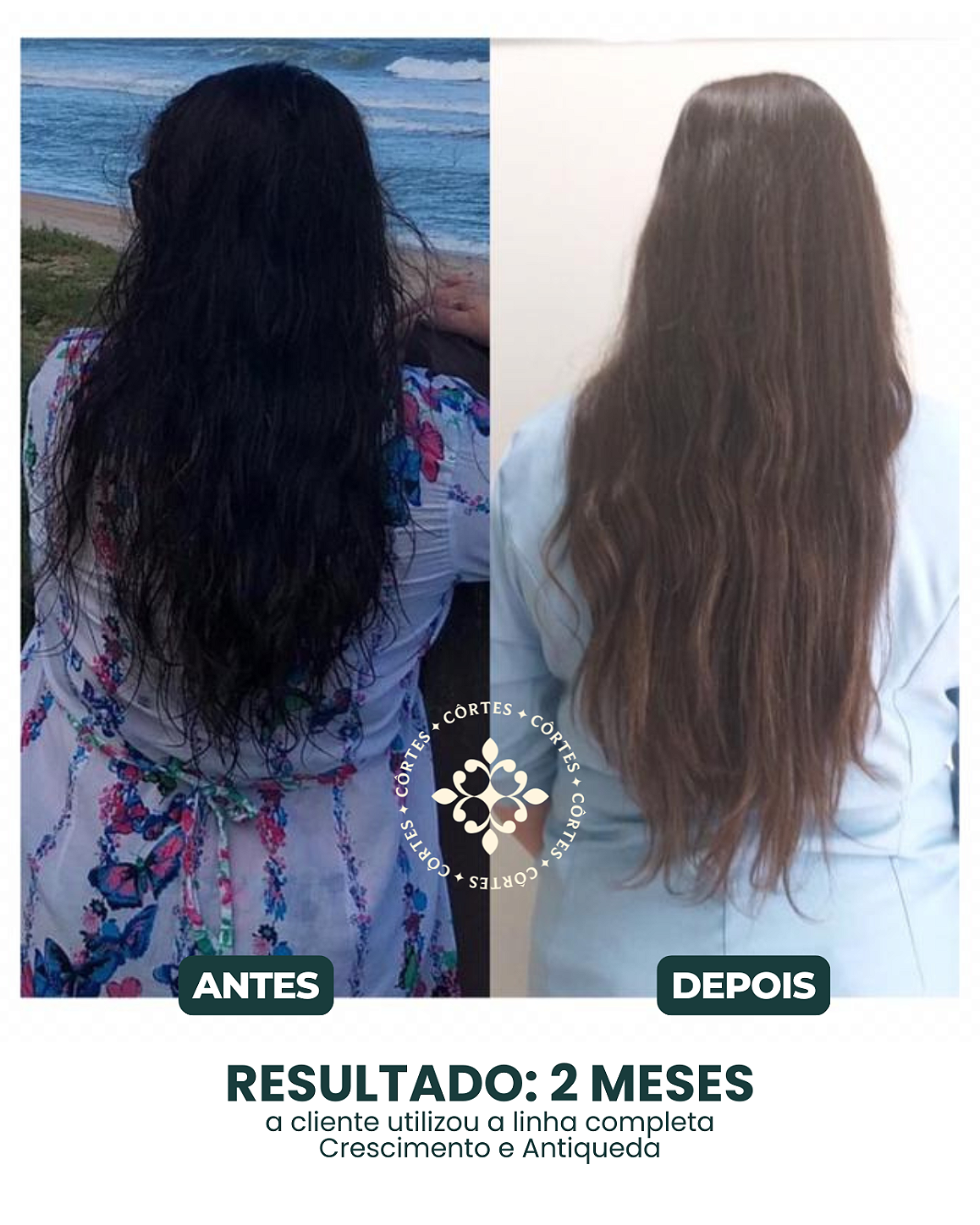 Antes e Depois 5