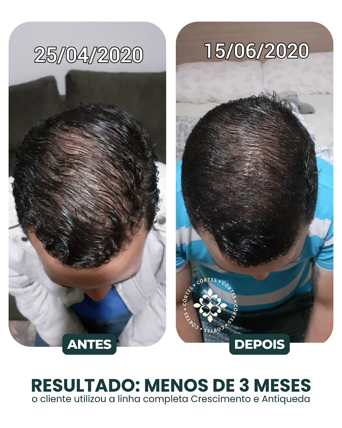Antes e Depois 6