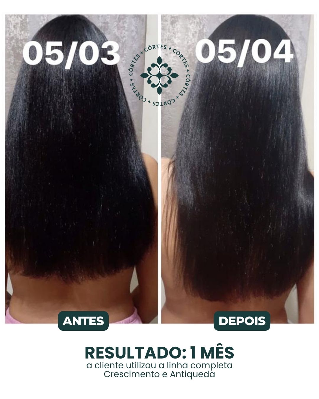 Antes e Depois 5