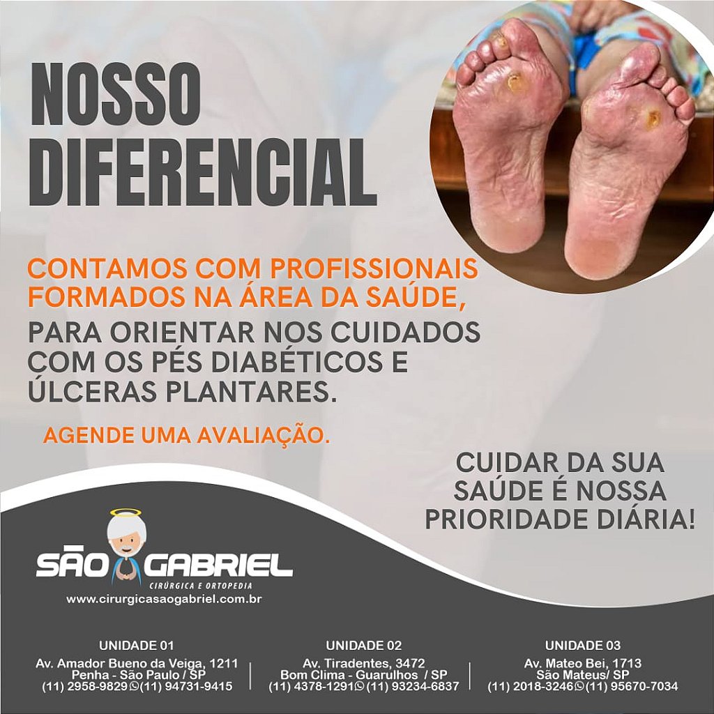 Cinta Abdominal - Cirúrgica São Gabriel - Produtos Ortopédicos