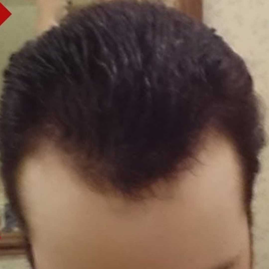 Cabelo forte depois do tratamento