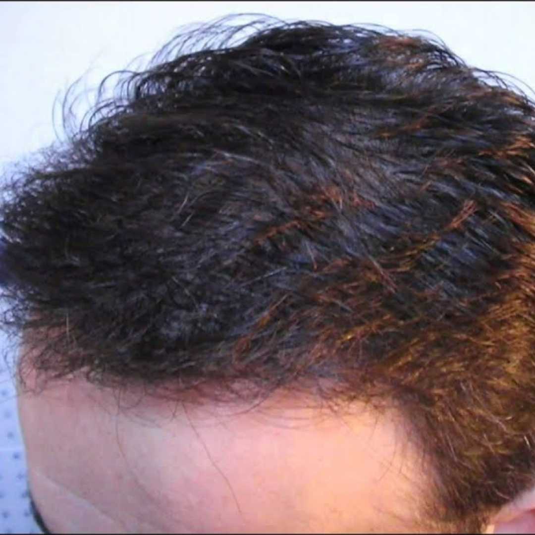 Cabelo forte depois do tratamento Ozo Be