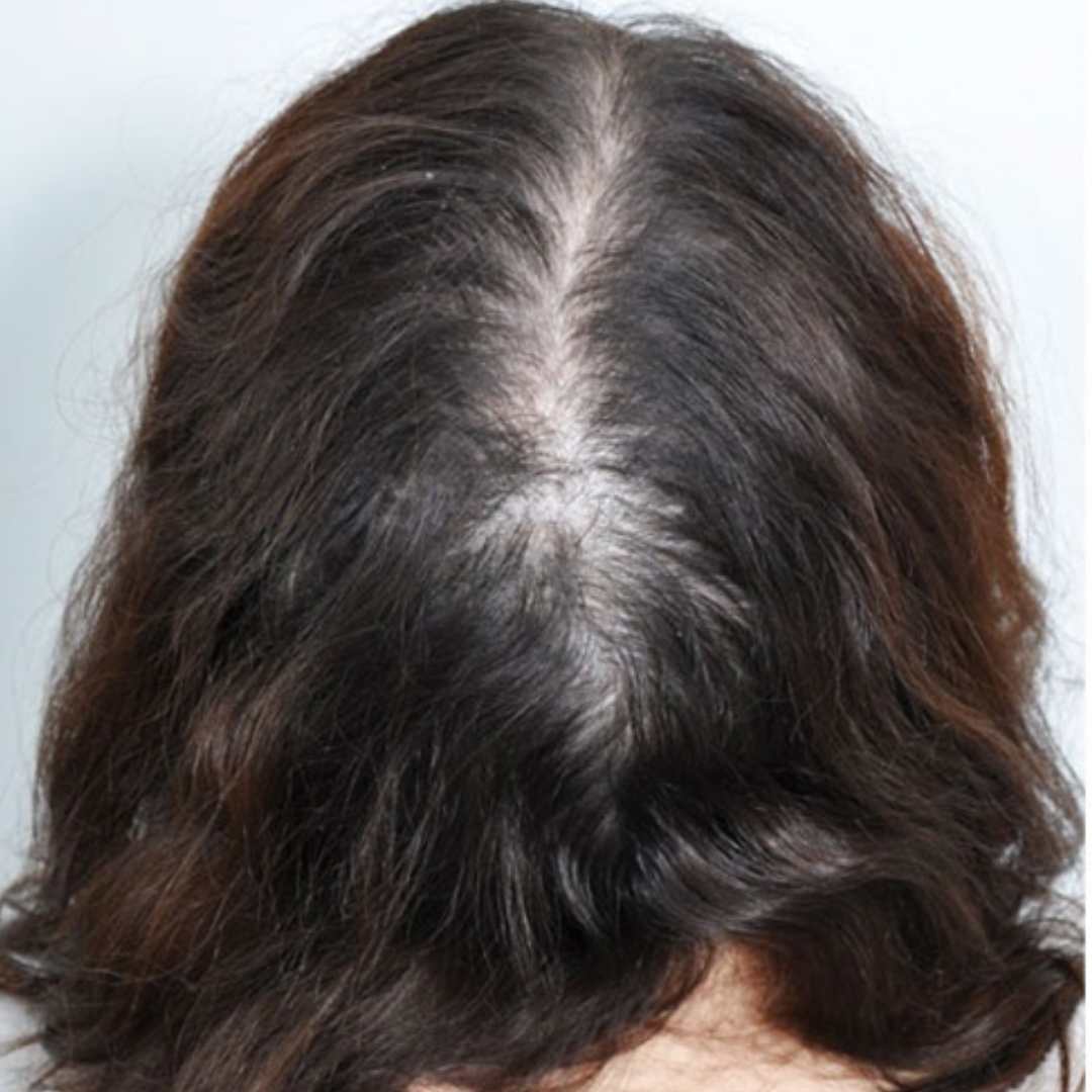 Cabelo fraco antes do tratamento