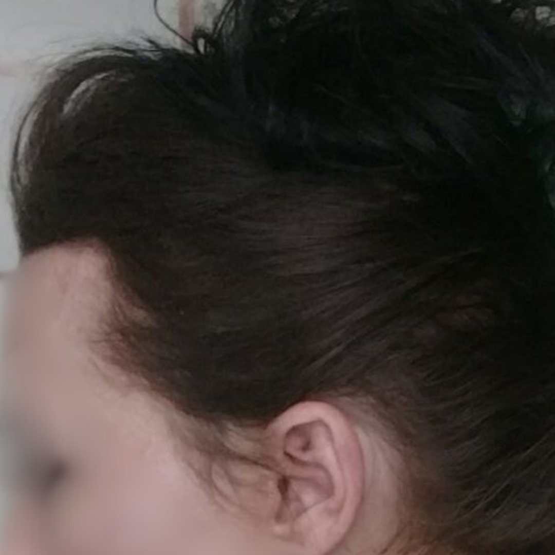 Cabelo denso depois do tratamento