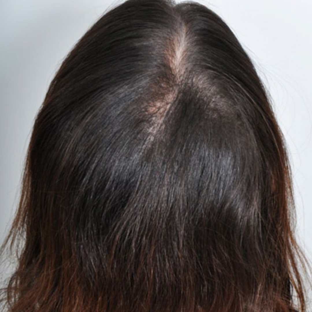 Cabelo forte depois do tratamento