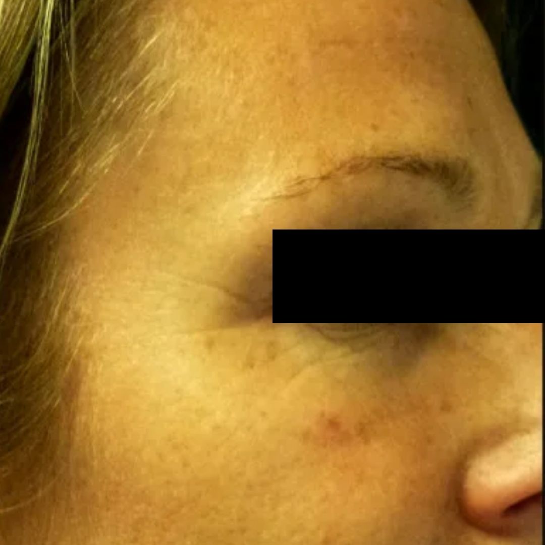 Pele rejuvenescida depois do Sérum Ozo Be