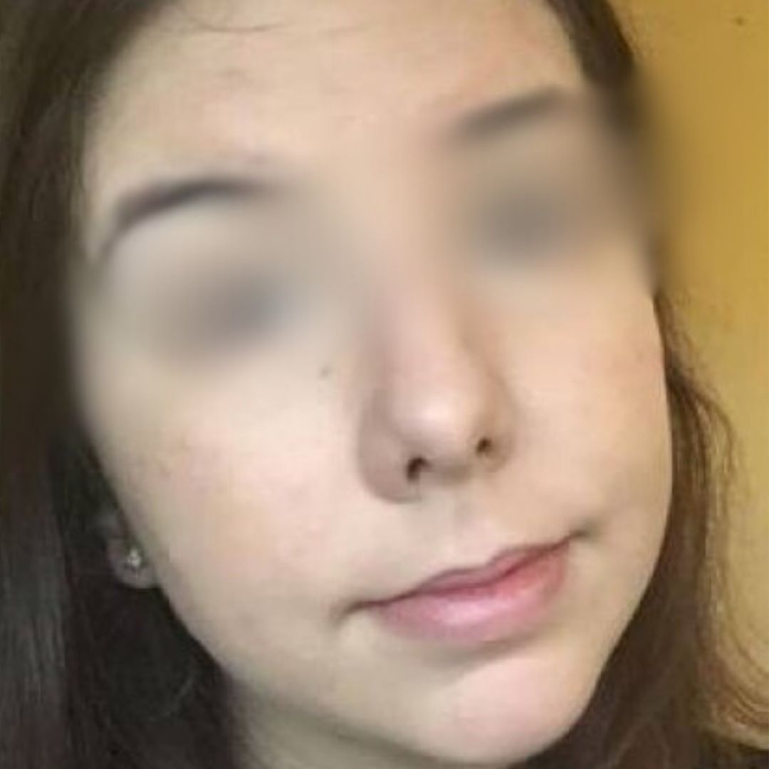 Pele limpa depois do Sérum Ozo Be