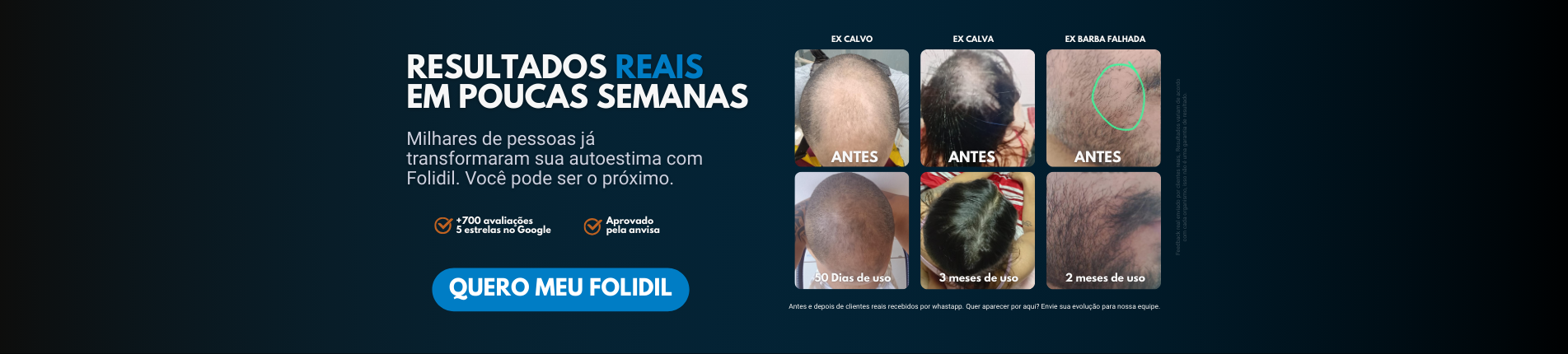 Antes e depois