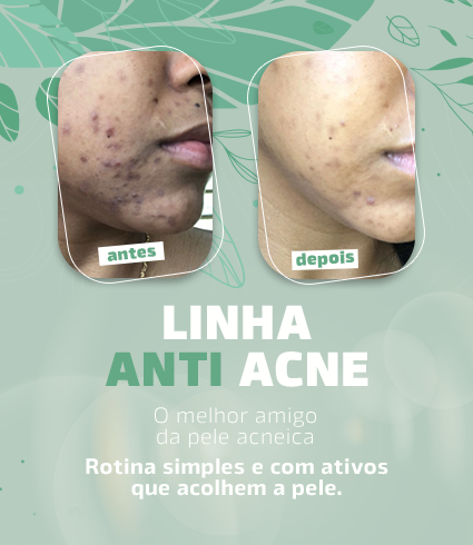 [mobile] BANNER 05 KAROL