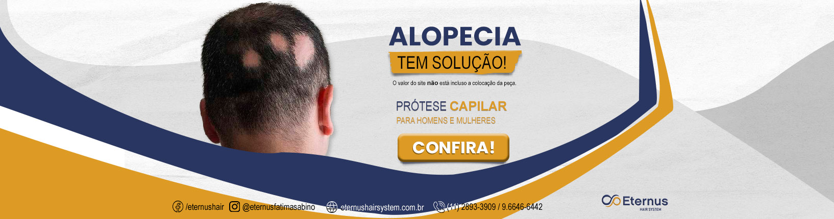 ALOPECIA