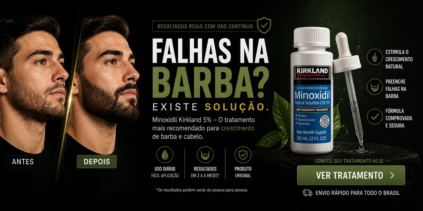 Minoxidil Kirkland Original