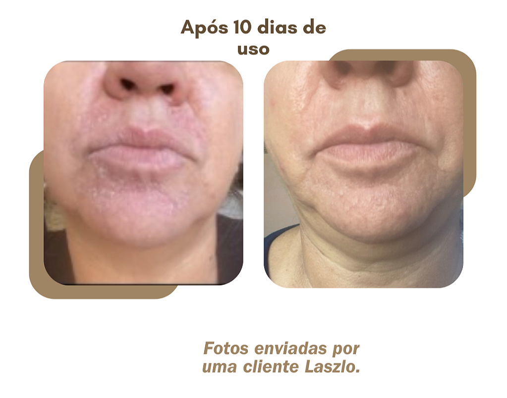 Laszlo CB Cream - Creme Hidratante com Copaíba, Sandalore e