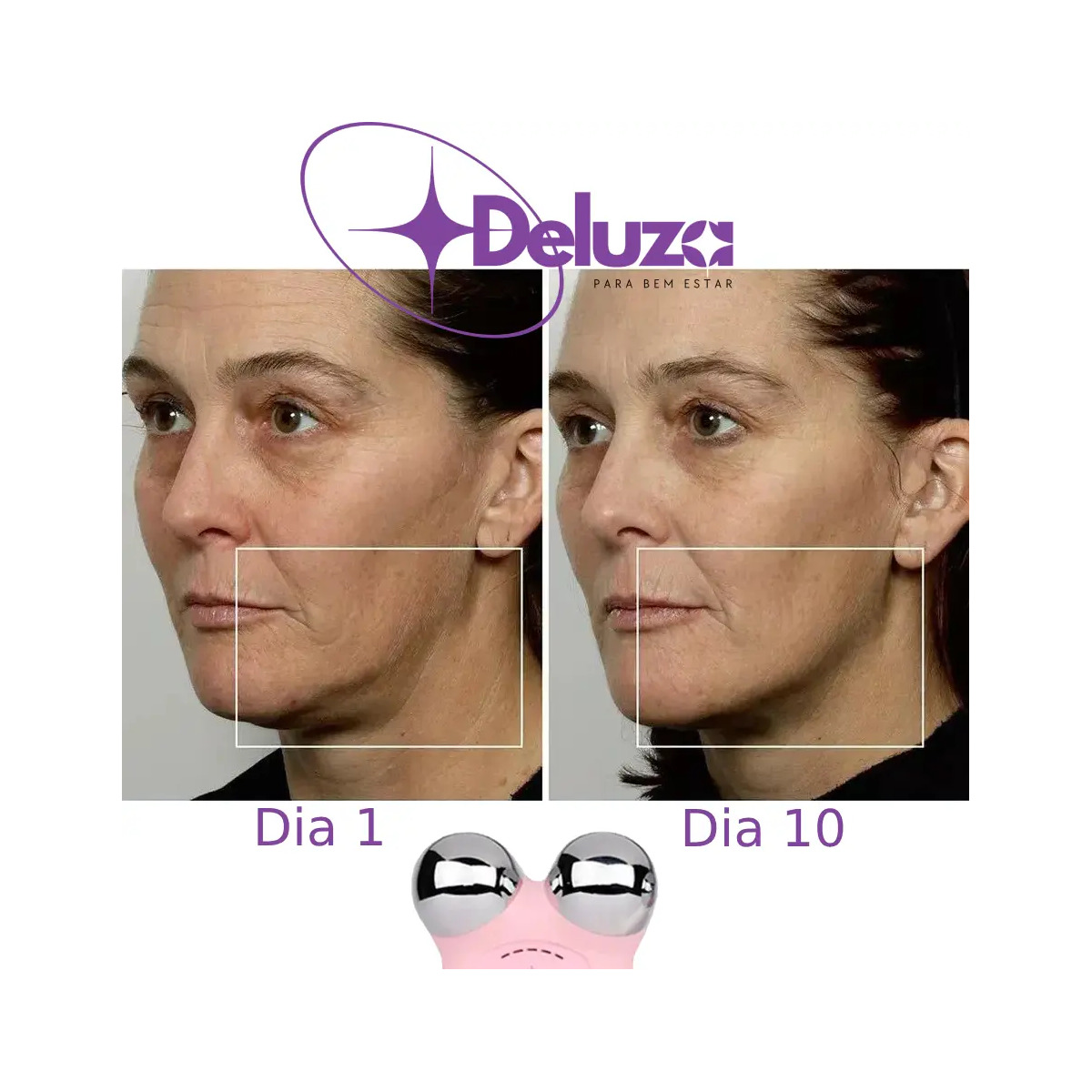 Micro Lift Massageador Facial Microcorrente Lifting Do Rosto