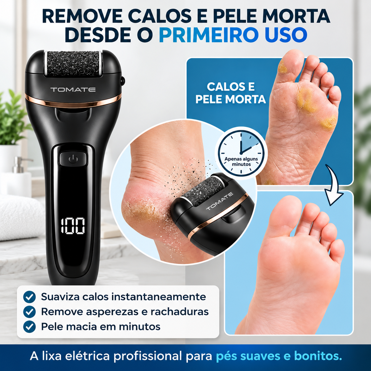 Lixa Elétrica Para Pés Recarregável Usb Removedor De Calos MAG-043 TOMATE