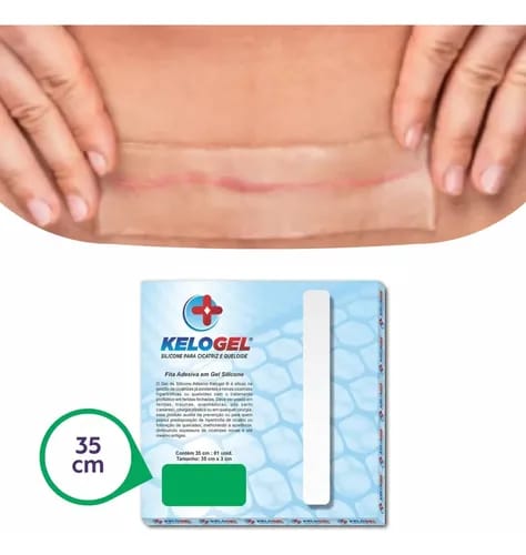 Fita Em Gel De Silicone Para Cicatriz 35cmx3cm Kelogel