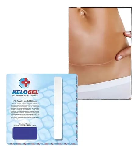 Fita Adesiva Gel De Silicone T Invertido Mama 2 Un Kelogel