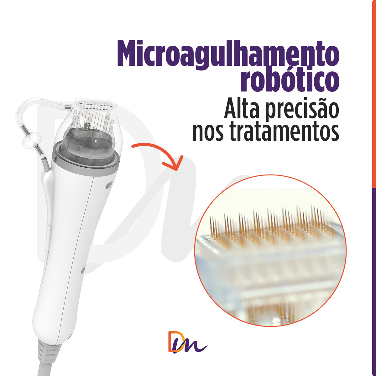 Needle RF Equipamento de Radiofrequência Microagulhada - HTM