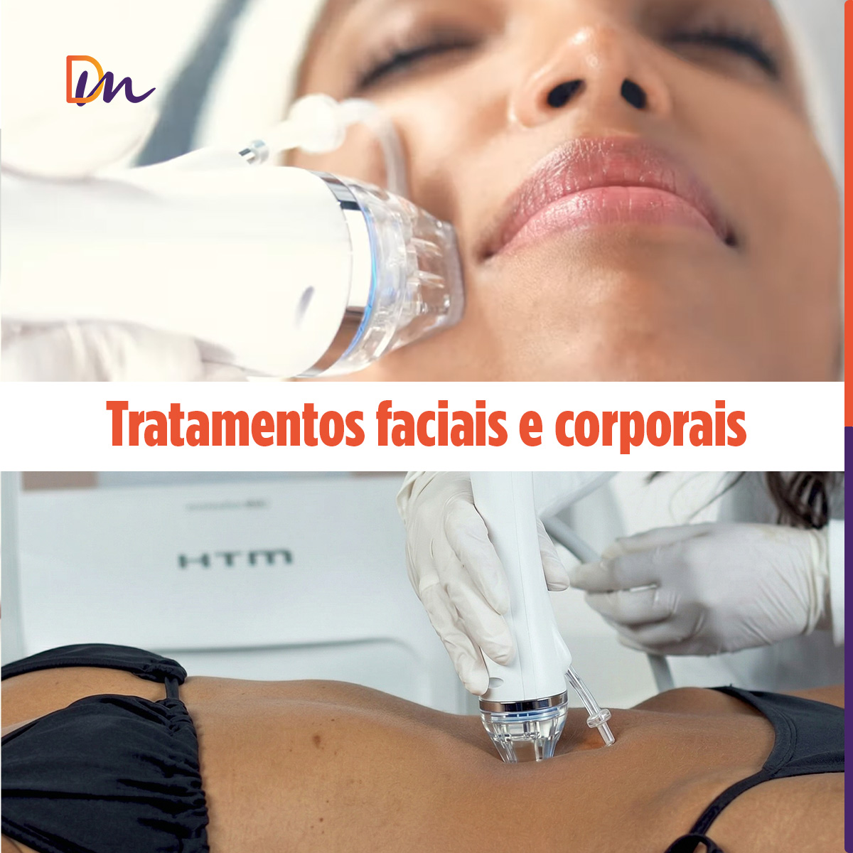 Needle RF Equipamento de Radiofrequência Microagulhada - HTM