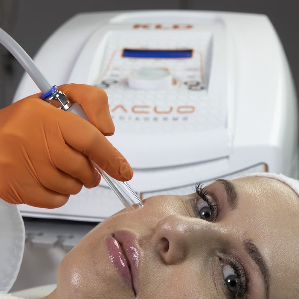Aparelho Hygiadermo Vácuo Vacuoterapia, Endermologia e Peeling Mecânico - KLD Biossistemas