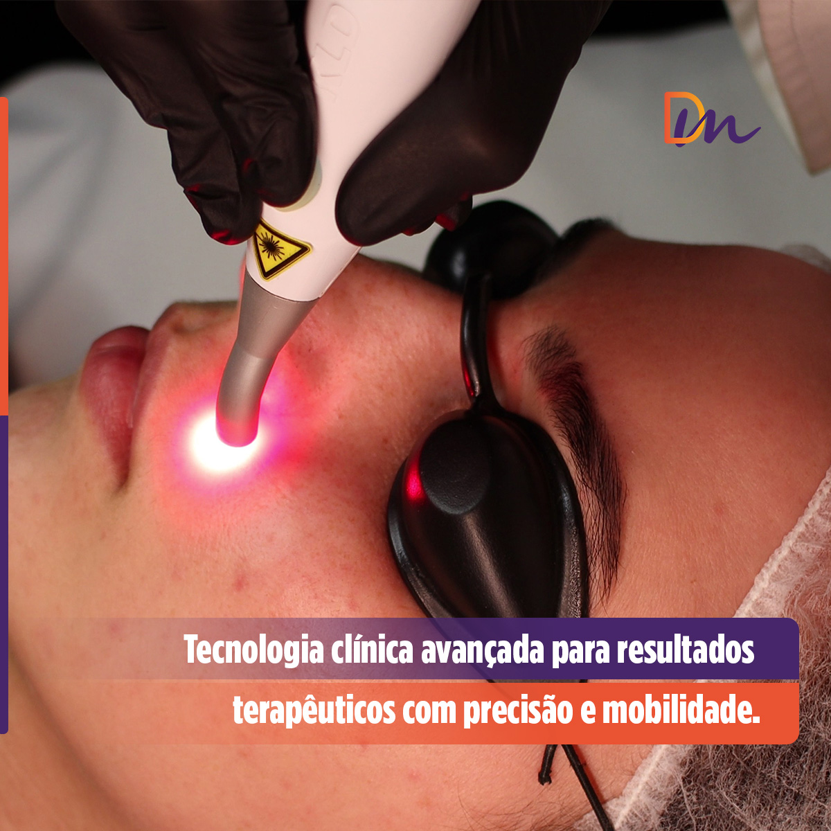 Endophoton Lite 660 Laser De Baixa Intensidade Sem Fio - KLD Biossistemas
