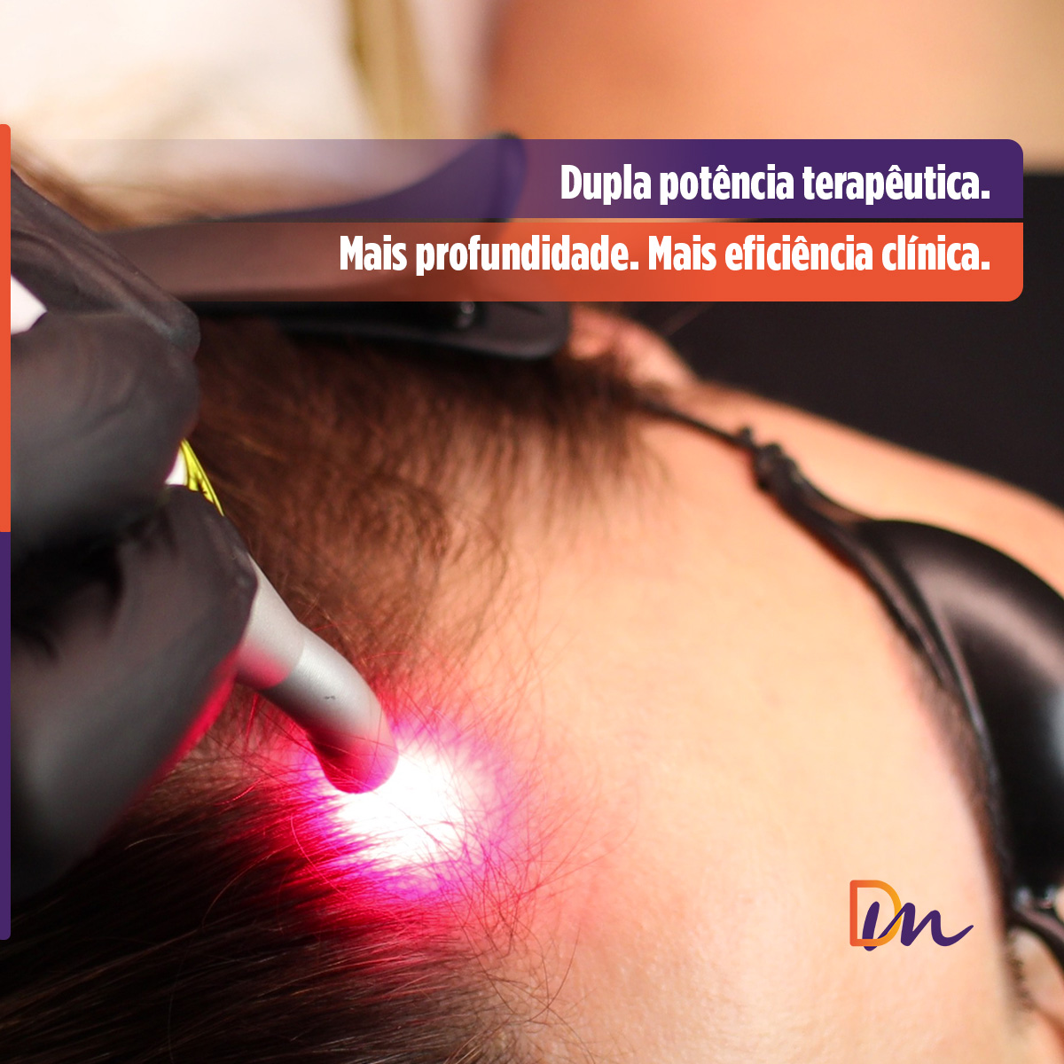Endophoton Lite 660 + 808 LLT2407 - KLD Biossistemas
