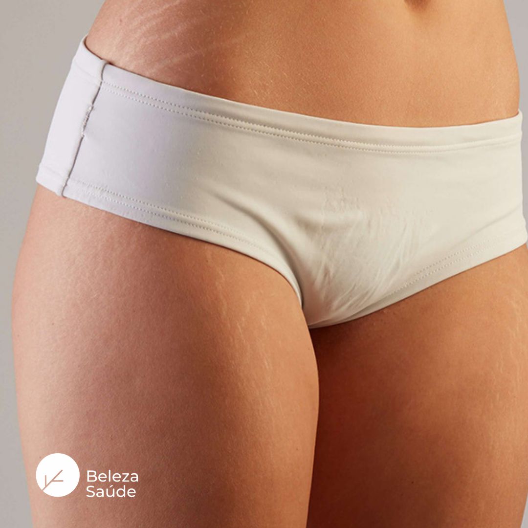 Creme para Estrias Brancas : Redutor das Marcas, Regenera a Pele