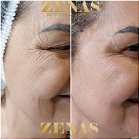 Skinbooster
