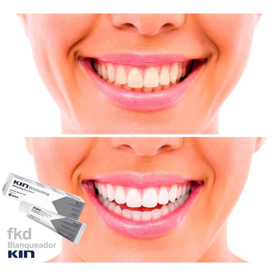 Kit Dental Viagem Kin Whitening Escova Creme e Necessaire - DH Utility |  Produtos de saúde e higiene pessoal
