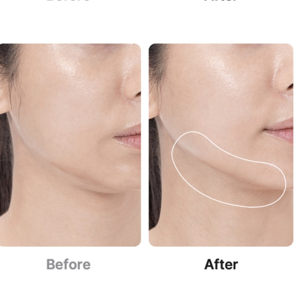 AGE-R Booster Pro Pink Medicube - Cosmeticos da ray