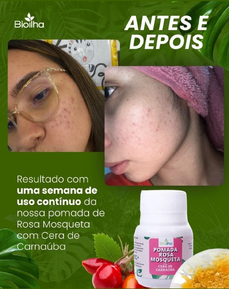 Pomada de Rosa Mosqueta 30g (Rosehip Ointment 30g) - Bioilha