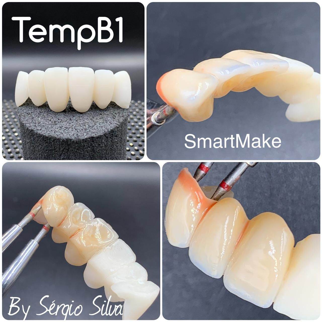 Kit Completo SmartMake - SMART DENT