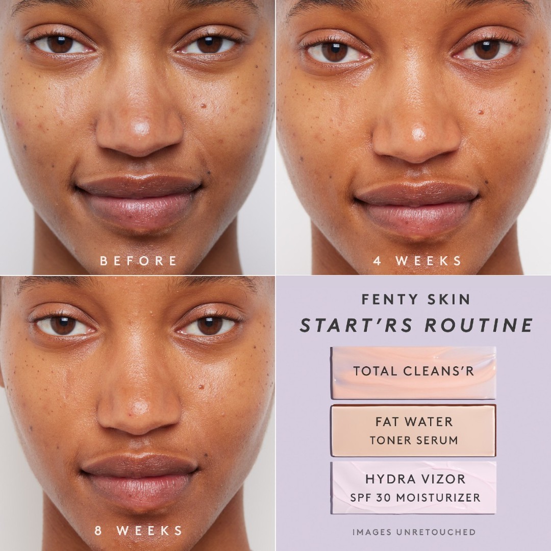 Removedor de Maquiagem Fenty Skin Total Cleans'r MakeupRemoving