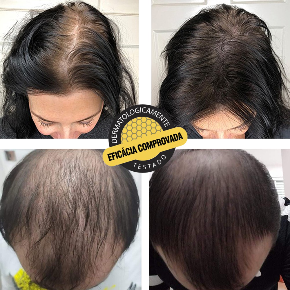 Mini Combo Antiqueda Engrossador De Cabelo + Reparador Hidrabell ...
