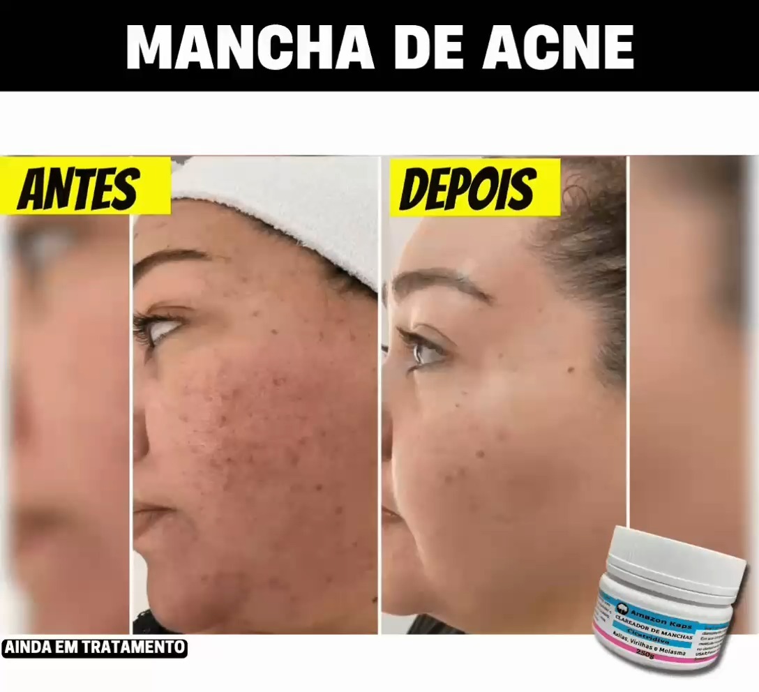CLAREADOR DE MANCHAS AMAZOLE - Amazon kaps
