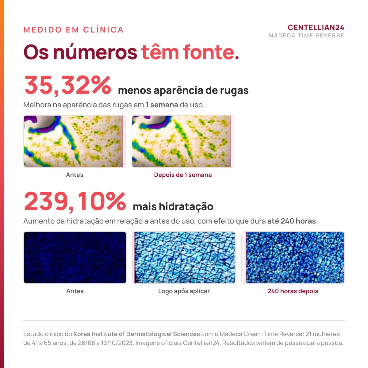 Resultados clínicos do Madeca Cream Time Reverse: 35,32% menos aparência de rugas em 1 semana e 239,10% mais hidratação