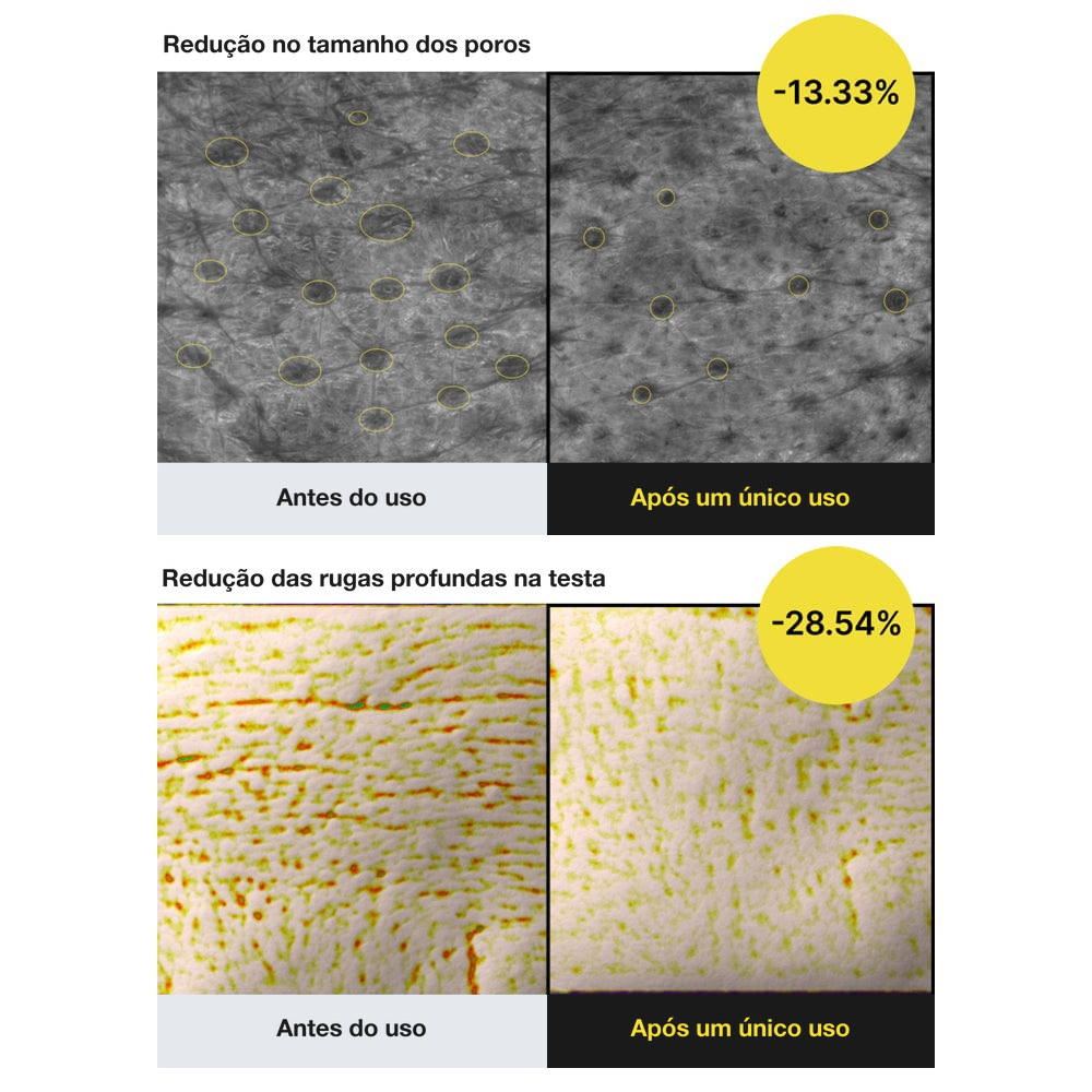 Infográfico dos testes clínicos do Celimax Retinal Shot Booster: redução de 13,33% no volume dos poros e 28,54% nas rugas da testa