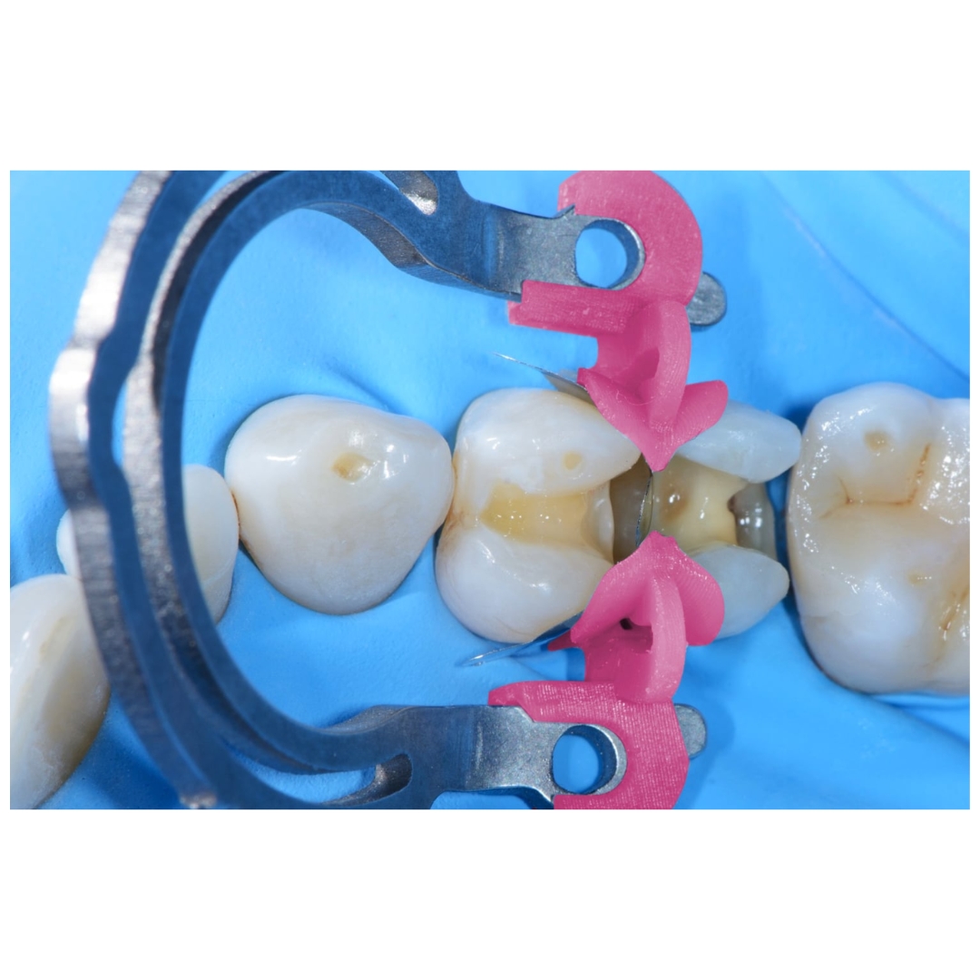 Sistemas de Matrizes myQuickmat Prime Kit Polydentia Quinelato