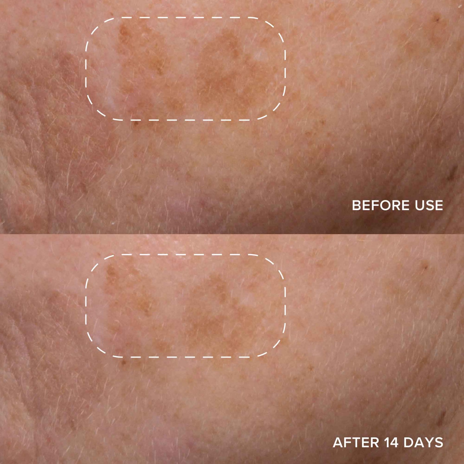 Alpyn Beauty Vitamin C & Bearberry Instant Glow Serum Consumos da Martina