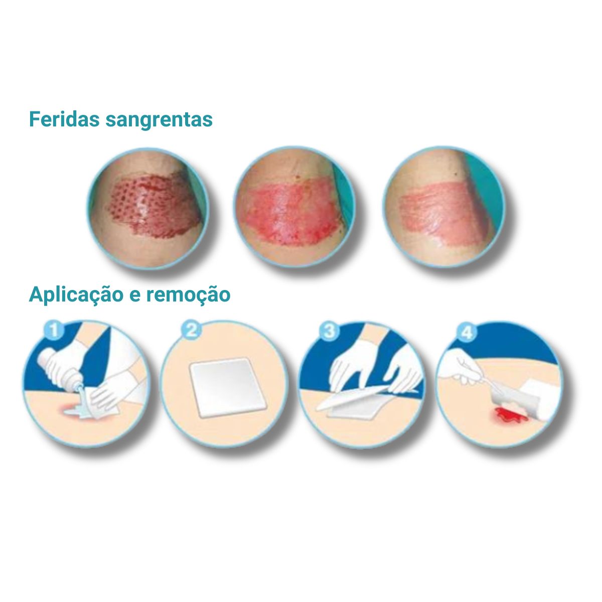 Curativo Alginato de Cálcio e Sódio 10cm x 10cm - Curatec