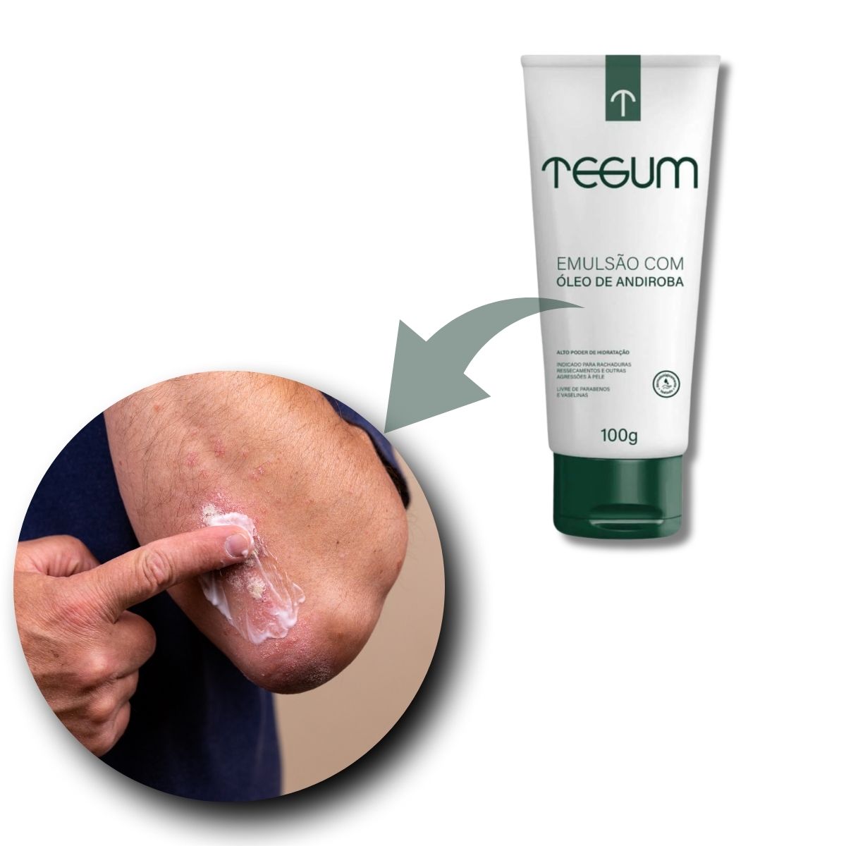 Creme Hidratante de Emulsão com Óleo de Andiroba - Tegum - RareMed