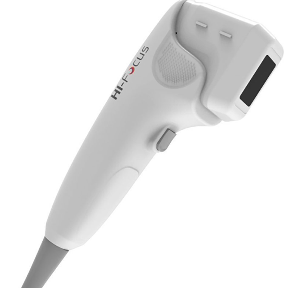 HI-Focus - Ultrassom focalizado de alta intensidade (HIFU) - HTM