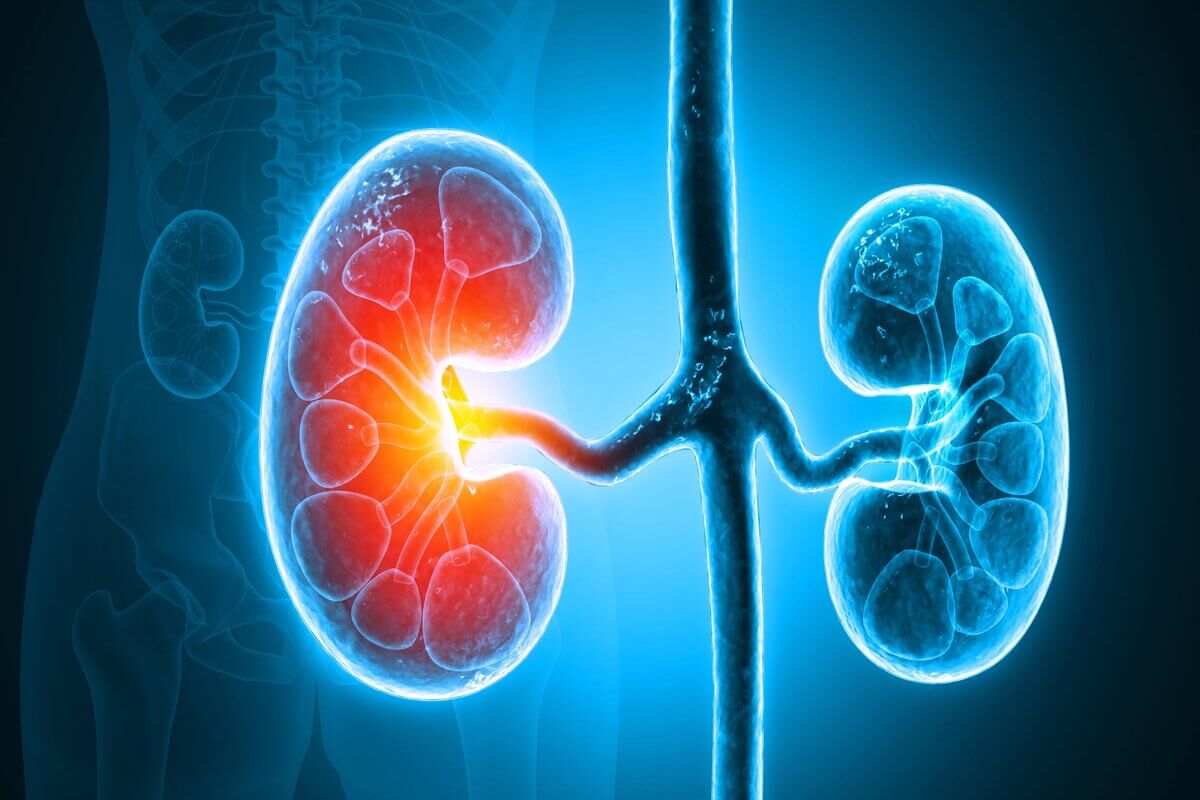 Doenças Renais