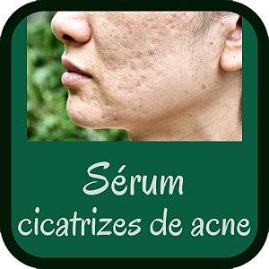Sérum Fluído para Cicatrizes de Acne (uso no microagulhamento - 30g)