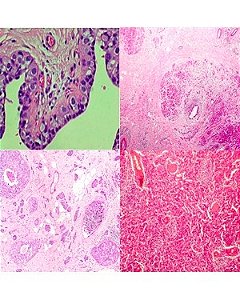 Conjunto de lâminas preparadas para Patologia - 30 peças