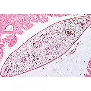Conjunto de 30 lâminas preparadas de Parasitologia